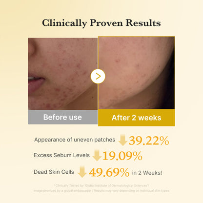 Medicube Kojic Acid Turmeric Pad 70Pcs