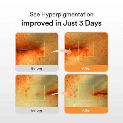 ABIB GLUTATHIOSOME DARK SPOT SERUM VITA DROP 50ml