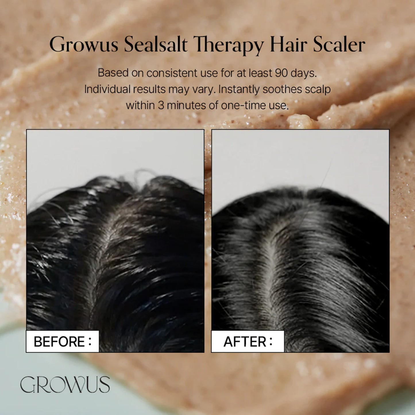 Growus Sea Salt Therapy Scalp Scaler 250G