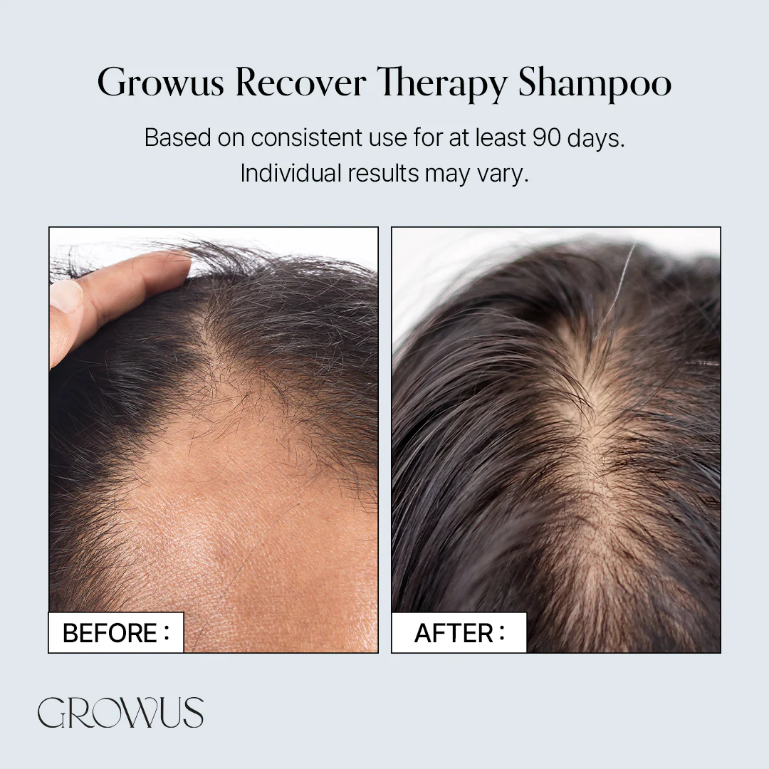 Growus Recover Therapy Shampoo For Woman 500ml