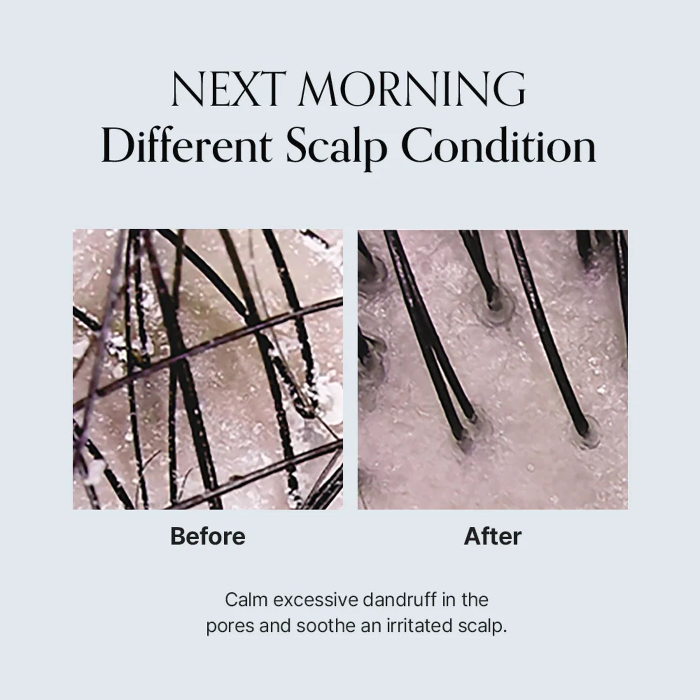 Growus Damage Therapy Scalp Scaling Ampoule 50ml