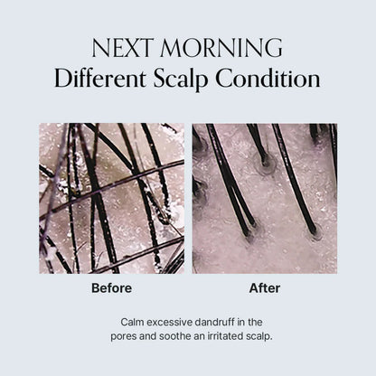 Growus Damage Therapy Scalp Scaling Ampoule 50ml