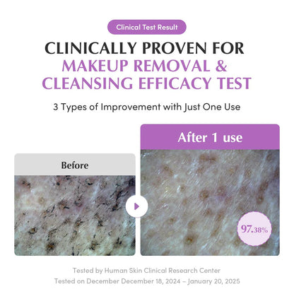 Eqqualberry Purple Rice Pore Smoothing Cleansing Oil 200Ml