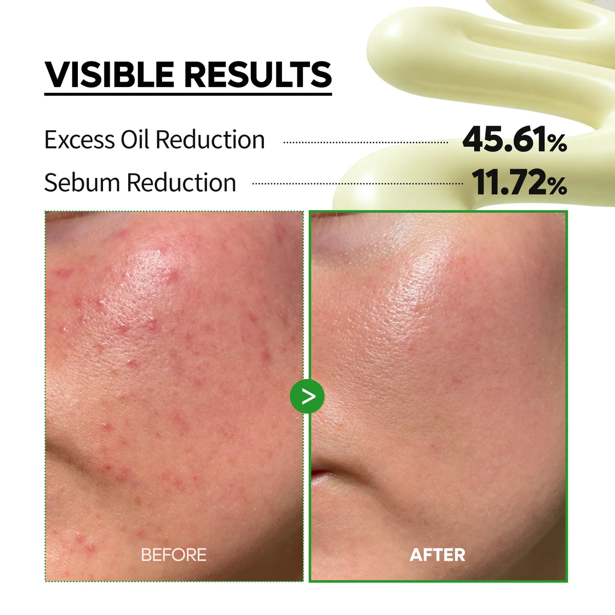 Dr.Melaxin S-Zinc Blemish Cream 100g