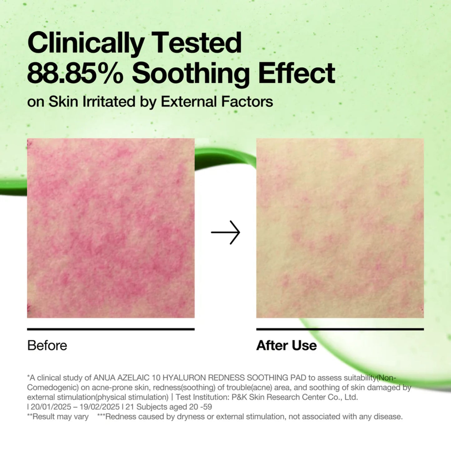 Anua Azelaic 10 Hyaluron Redness Soothing Pad 230Ml (90Ea)