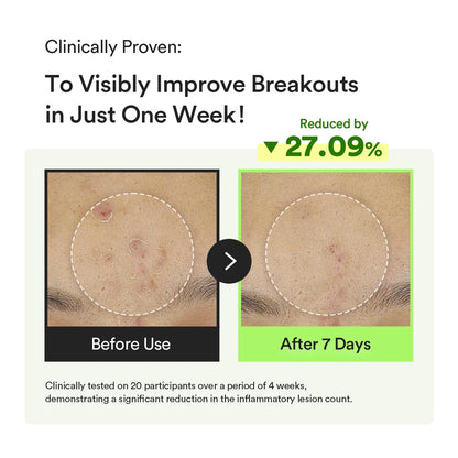 ABIB HEARTLEAF TECA CAPSULE SERUM CALMING DROP 50ml